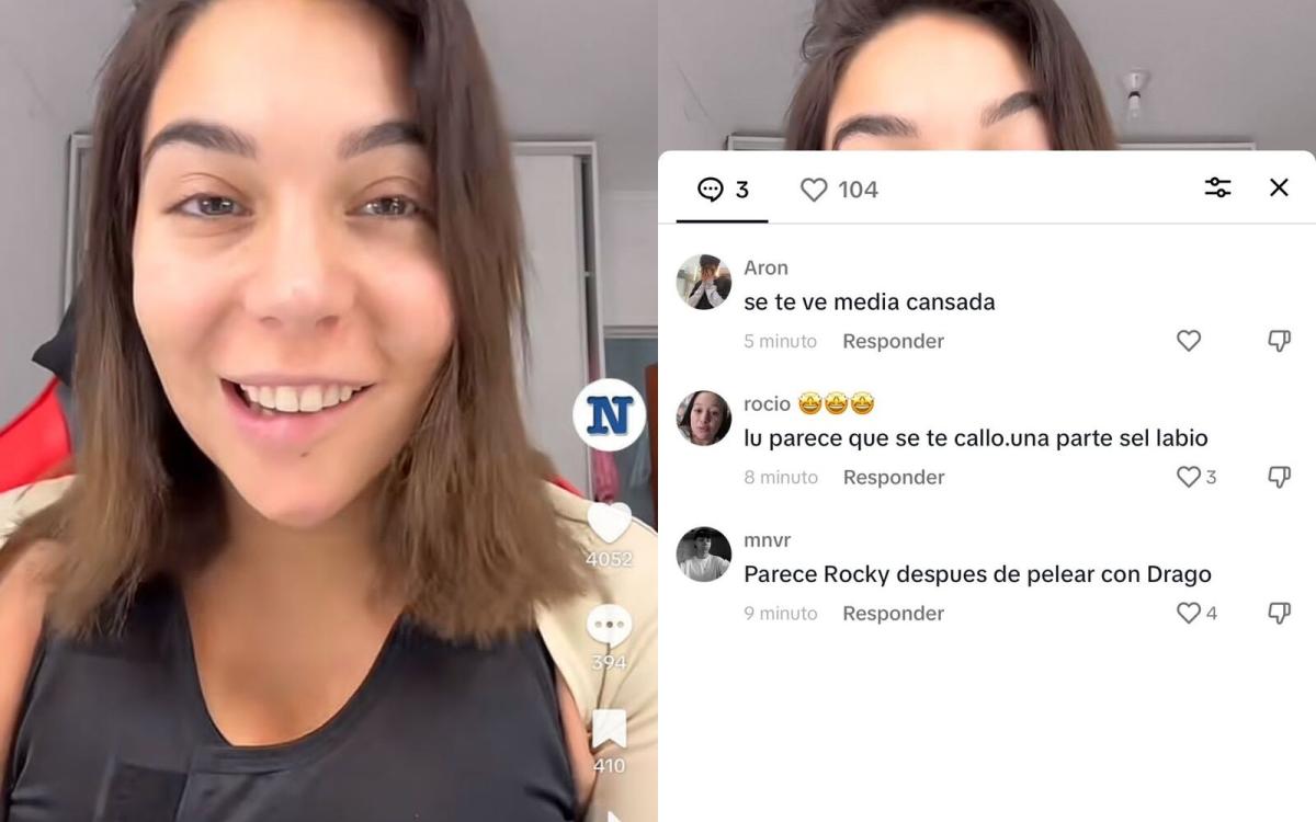 Luciana Milessi fue agredida en las redes sociales por las secuelas de una cirugía