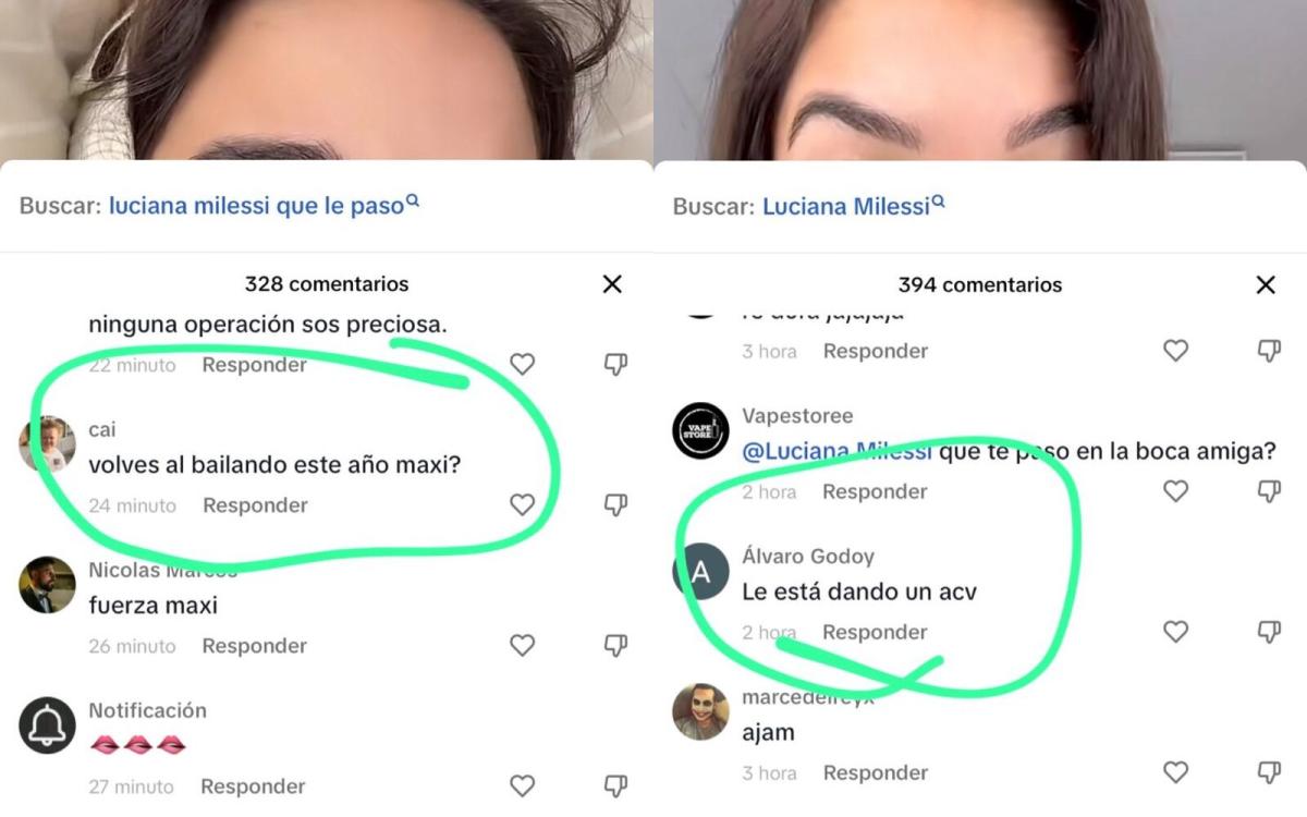 Luciana Milessi fue agredida en las redes sociales por las secuelas de una cirugía