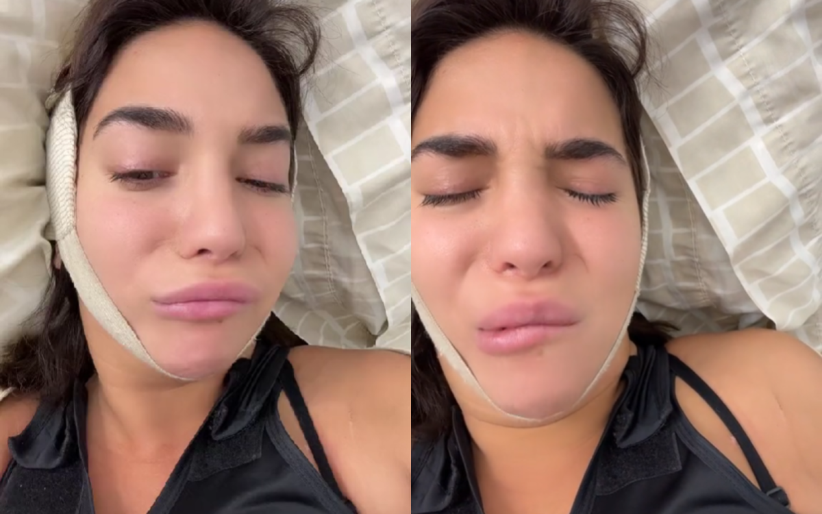 Luciana Milessi fue agredida en las redes sociales por las secuelas de una cirugía